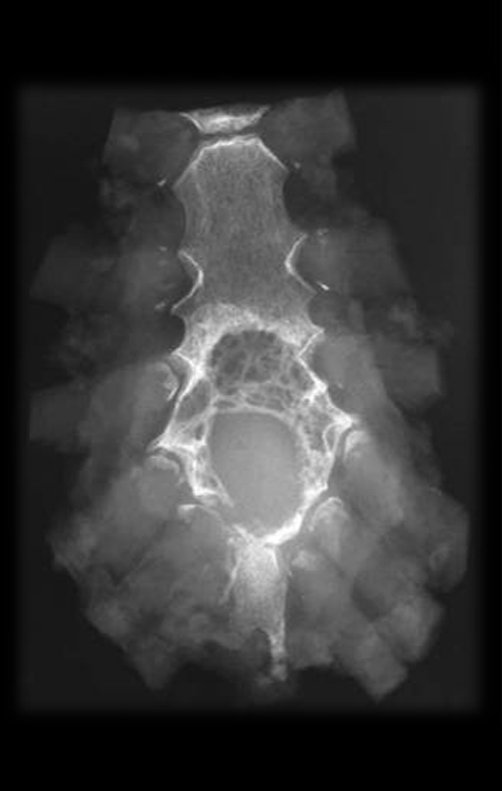 Figura 33: Radiografia da peça evidenciando o lesão.