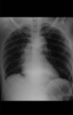 Figura 17: Radiografia do tórax PA.