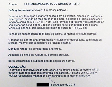 Figura 4: Laudo: lesão sólida, heterogênea e expansiva medindo 5,5 x 3,4 x 1,7 cm. Sugere a realização de Ressonância magnética.