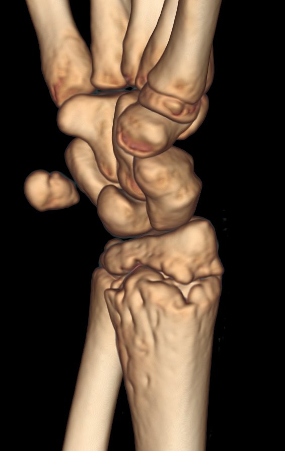 Figura 154: Reconstrução tomográfica de 31/Maio/2016, sagital.