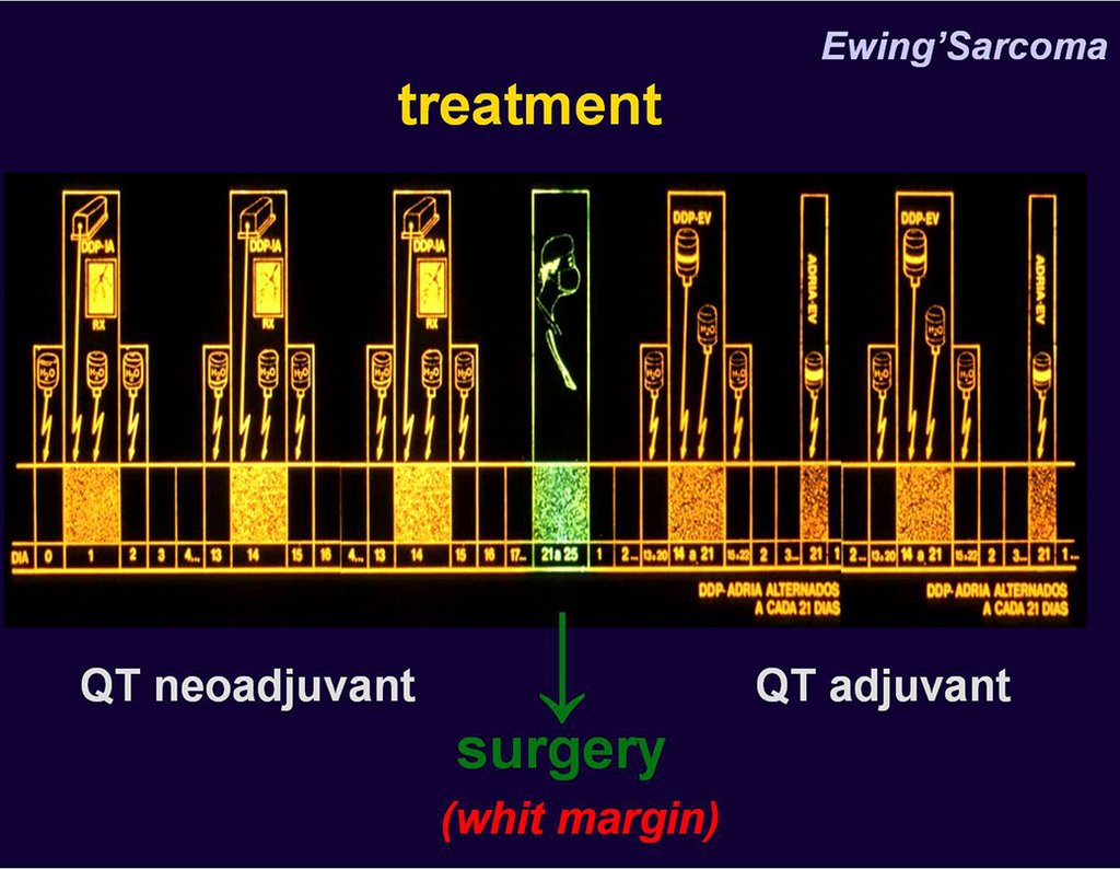 Figura 13: Esquema de quimioterapia para o sarcoma de Ewing.