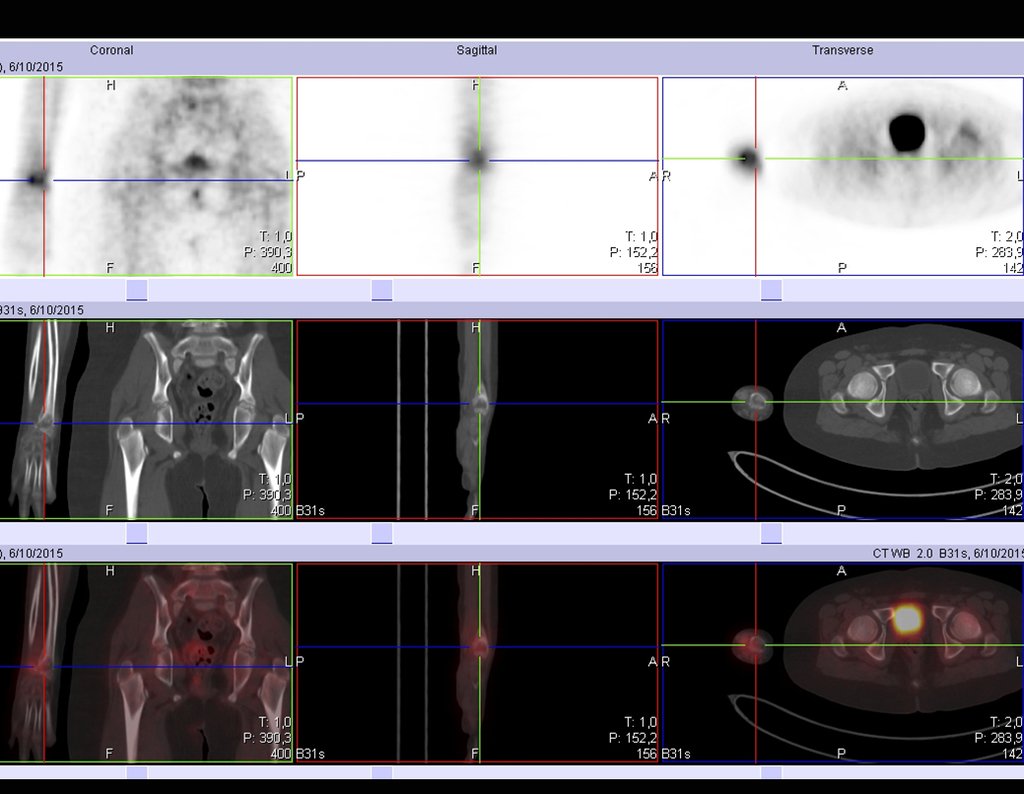 Figura 113: Pet cet em 06/10/2015