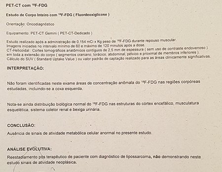 Figura 85: Laudo da ressonância de controle de fevereiro de 2016, sem sinais de recidiva.