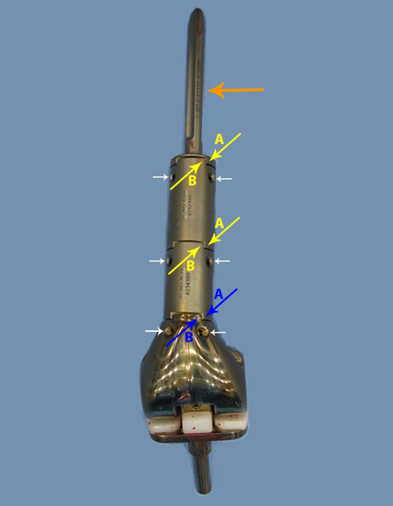 Figura 31: Prótese confeccionada sob encomenda, com os encaixes retangulares entre os módulos, bloqueando a rotação, setas amarelas A e B. As setas azuis assinalam o encaixe retangular do corpo da prótese. As setas brancas destacam os parafusos de fixação, mais fortes e em maior número. A seta laranja aponta a haste calibrada para o canal medular do paciente.