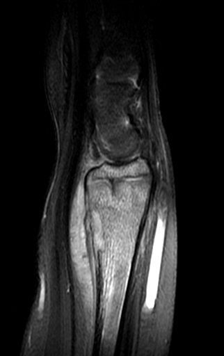 Figura 171: Rm sagital T2.