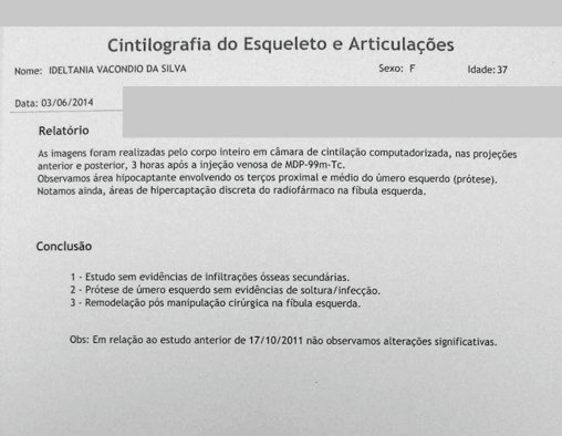 Figura 59: Laudo da Cintilografia, após 27 anos, sem anormalidade.