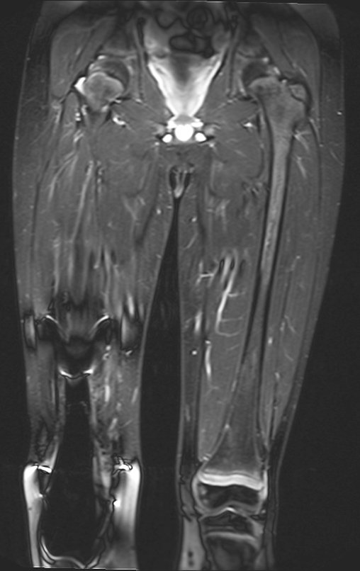 Figura 111: 9924 - RM cor-stir_2015-03-31.