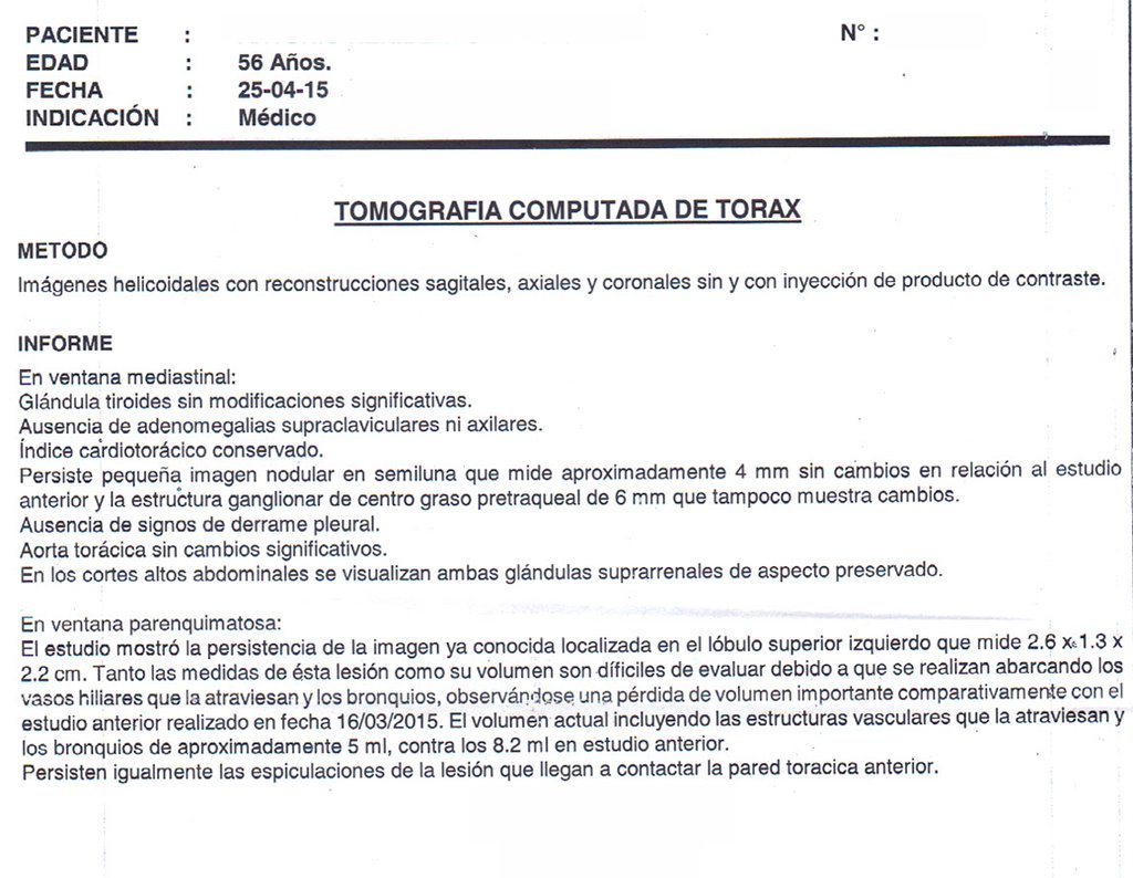 Figura 34: Laudo da tomografia de tórax.