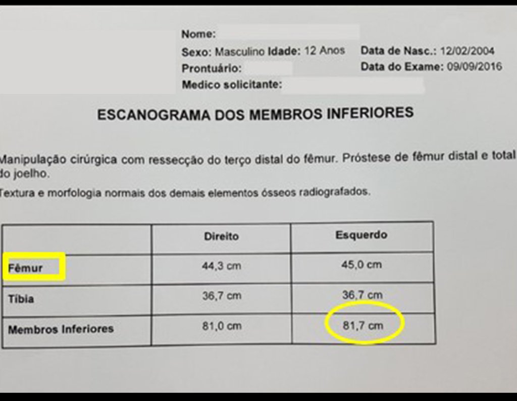 Figura 160: Laudo do escanograma de outubro de 2016. Discrepância de 0,7 cm.