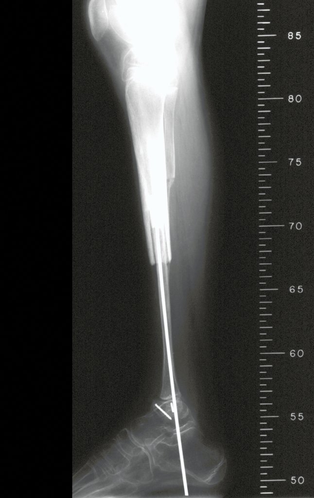 Figura 38: Radiografia perfil, em 1998.