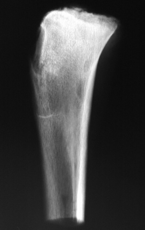 Figura 56: Radiografia da peça cirúrgica, perfil.