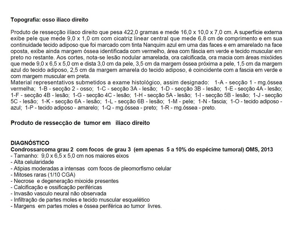 Figura 114: Laudo da peça cirúrgica. Condrossarcoma GII, com focos entre 5 a 10 % de GIII.