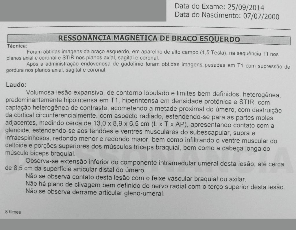 Figura 26: Laudo da RM do braço esquerdo.