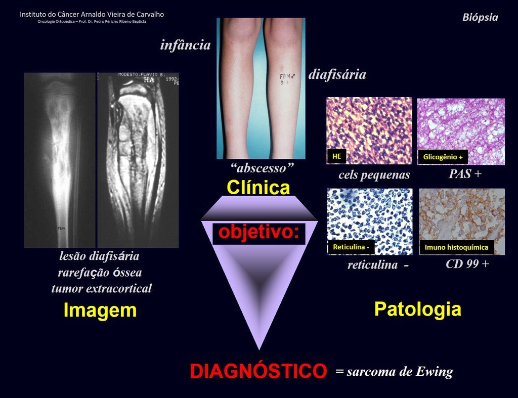 Figura 8: A clínica é a base, que tem o maior peso. Os dados de imagem em equilíbrio com a patologia equilibram a pirâmide, definindo o DIAGNÓSTICO preciso.