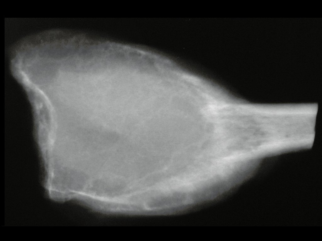 Figura 93: Radiografia frente, da peça cirúrgica.