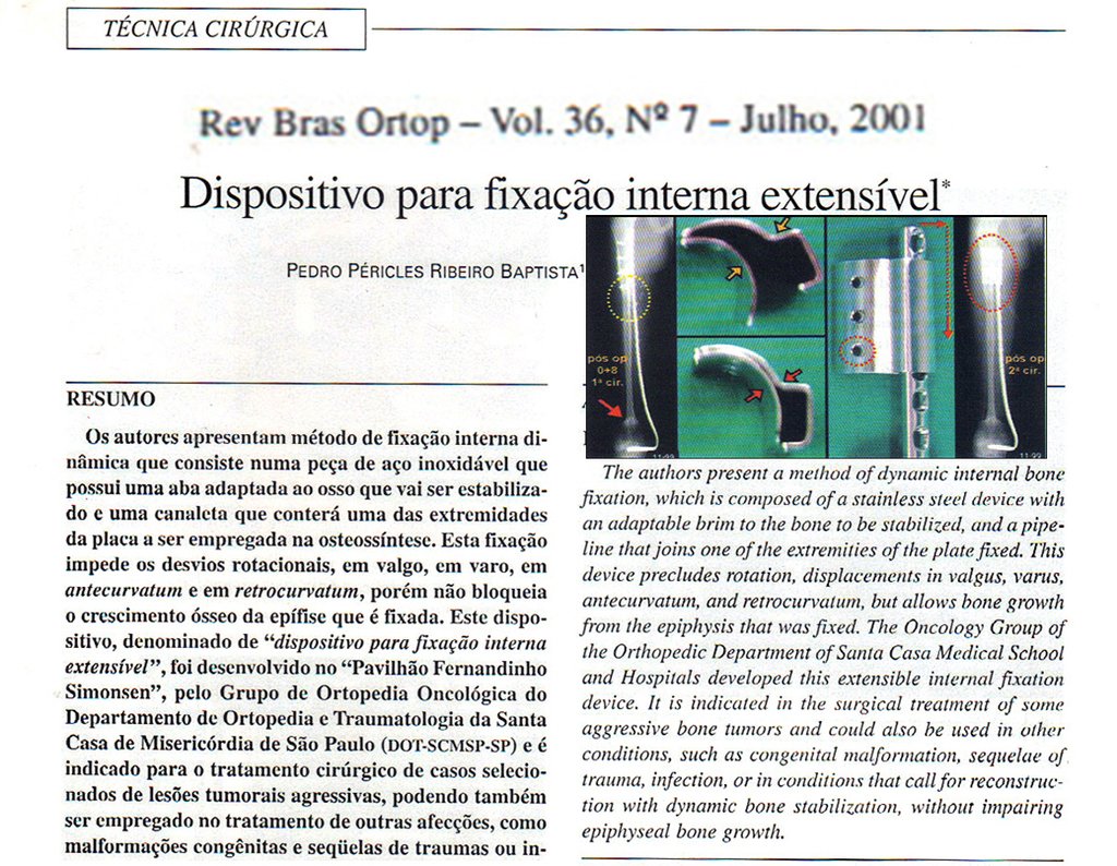 Figura 166: Artigo publicado na Revista Brasileira de Ortopedia - Vol. 36, Nº 7 - Julho de 2001.