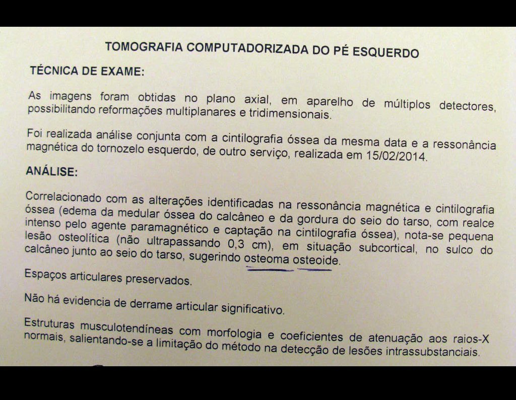 Figura 13: Laudo da TC do pé esquerdo.