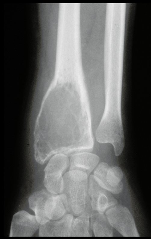 Figura 7: Radiografia frente, após cinco meses.