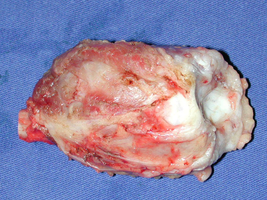 Figura 55: Face ulnar, integra.