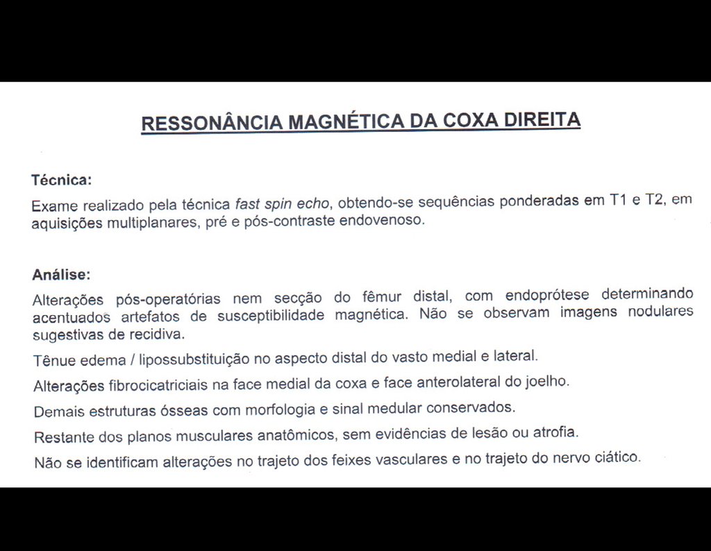 Figura 114: Laudo da ressonância magnética, pós operatória, de 31/03/2015