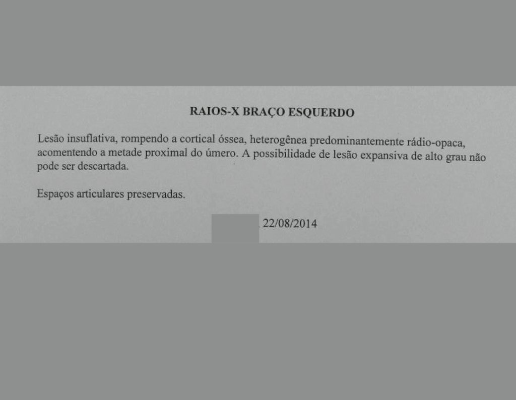 Figura 3: Laudo da radiografia do úmero esquerdo.