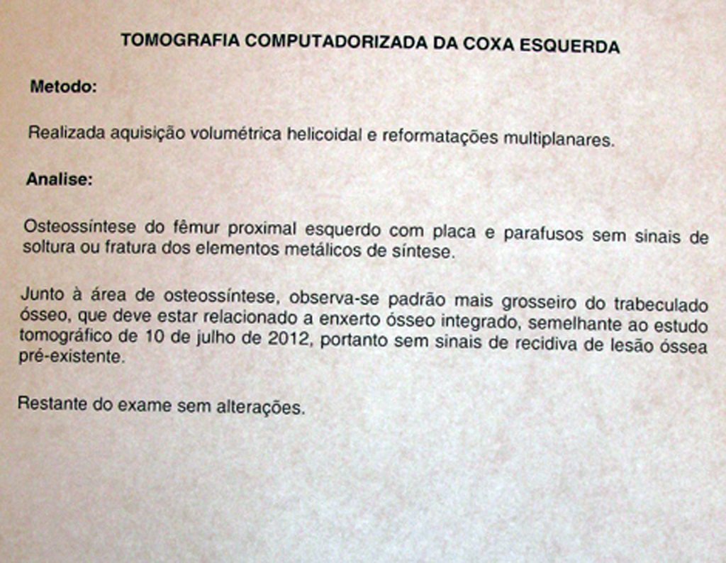 Laudo do tomografia computadoriza da coxa esquerda.