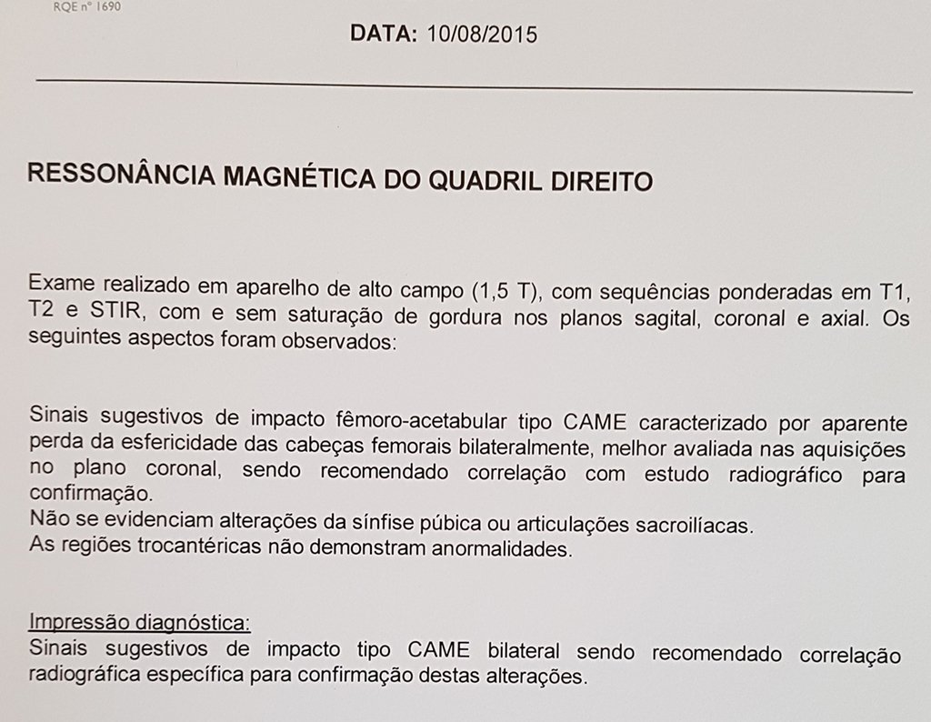 Figura 10: Laudo de artrorressonância magnética que sugere impacto fêmoro-acetabular !