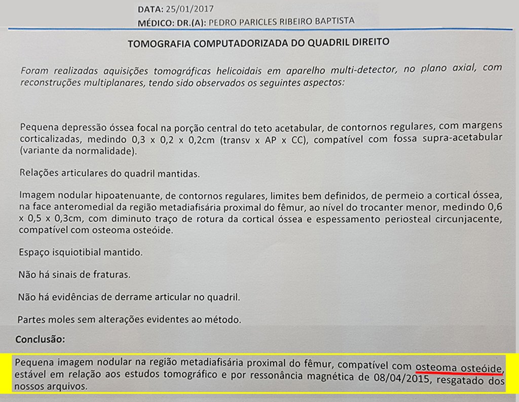 Figura 30: Laudo da tomografia de janeiro de 2017 reafirmando a presença com presença da lesão, já referida anteriormente.