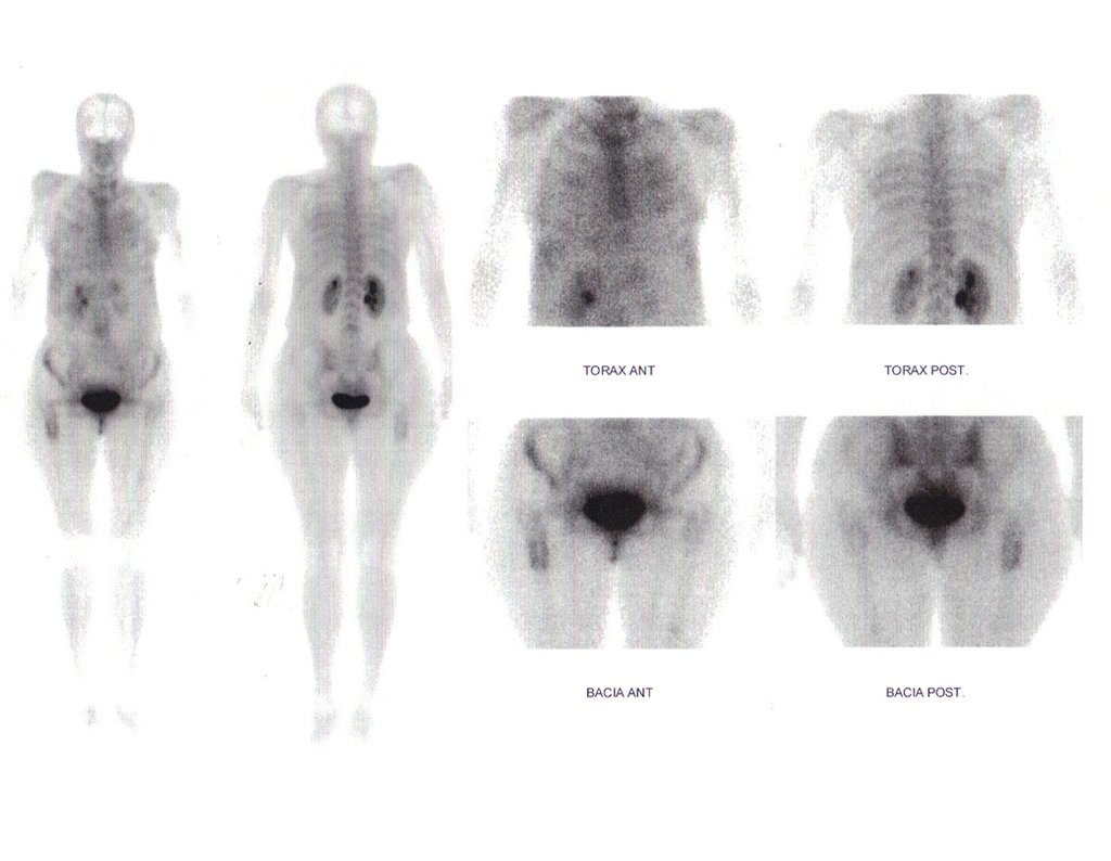 Figura 12: Cintilografia 2015-09-04