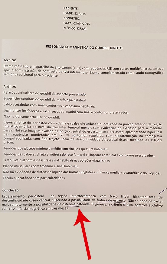 Figura 8: Laudo de ressonância relatando hipóteses diagnósticas. A seta vermelha salienta a hipótese de osteoma osteoide.