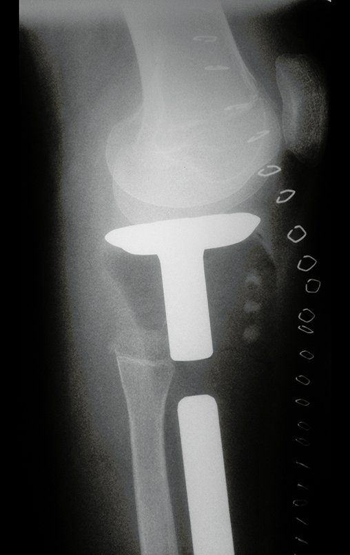 Figura 90: Radiografia em perfil.