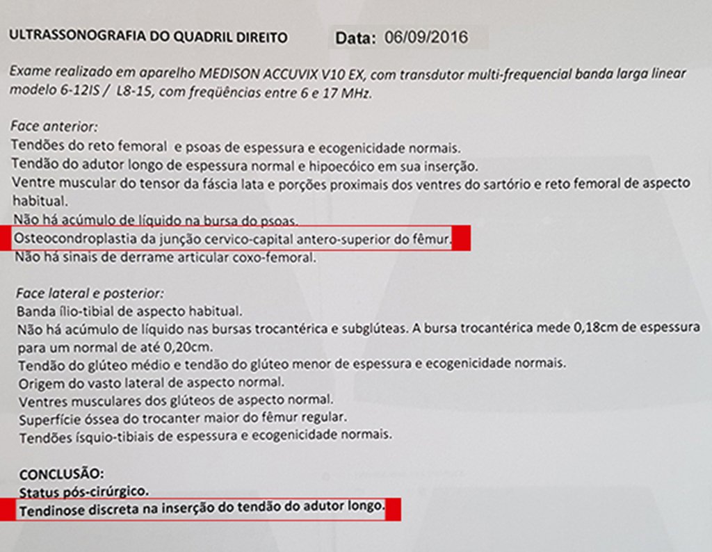 Figura 11: Ultrassonografia do quadril direito, em 06/09/2016