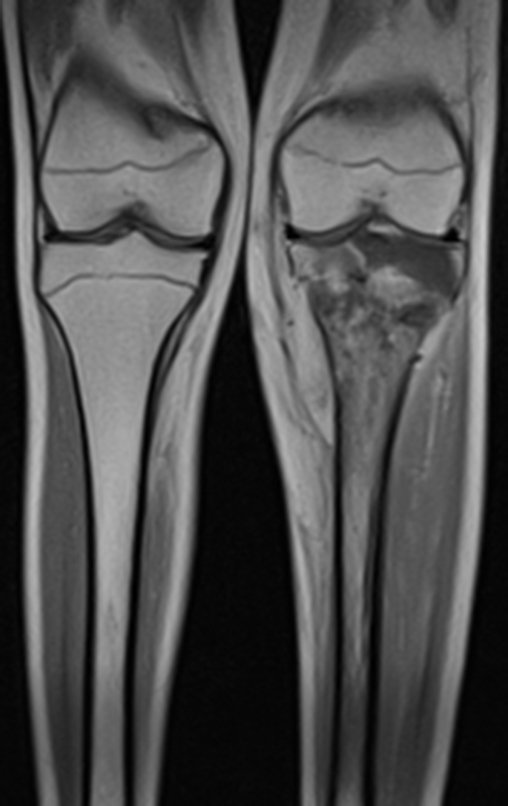 Figura 37: RM cor-T1-gad.