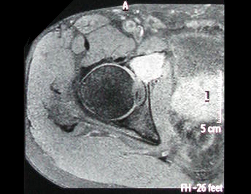 Figura 3: Rm axial T1 spir.