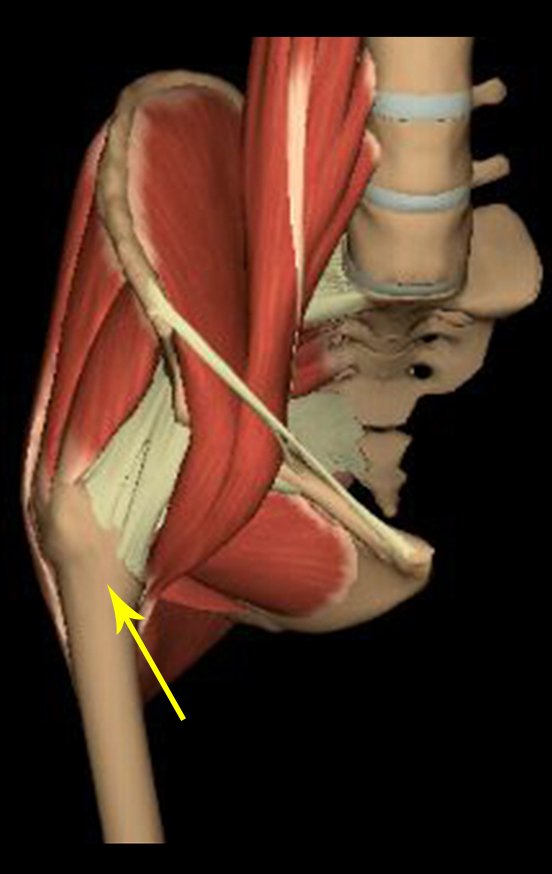 Figura 33: Anatomia músculo-esquelética da região da lesão, seta amarela.